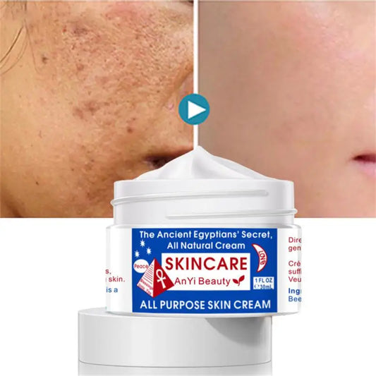 MagicAll Purpose Skin Face Cream